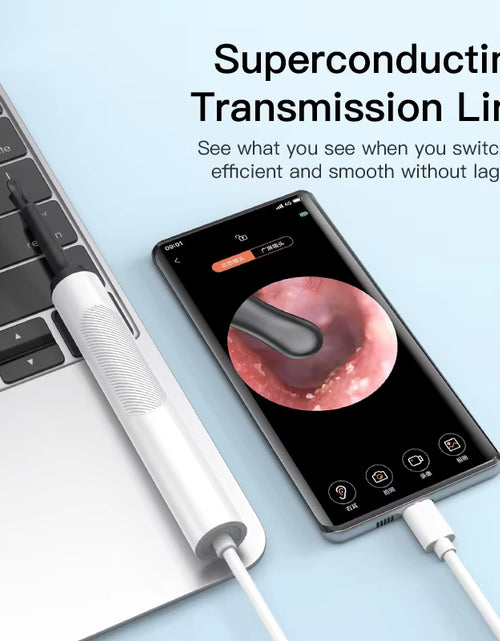 Load image into Gallery viewer, Professional Ear Cleaner with Camera - USB Type-C Endoscope for Wax Removal and Health Care
