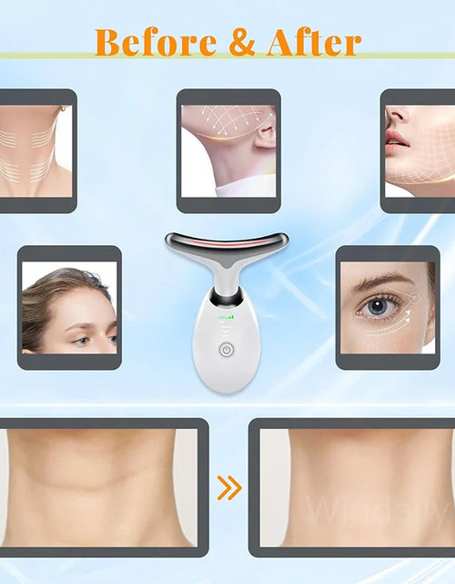 Load image into Gallery viewer, Compact design of the anti-wrinkle facial massager.
