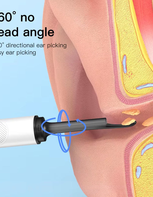 Load image into Gallery viewer, Professional Ear Cleaner with Camera - USB Type-C Endoscope for Wax Removal and Health Care
